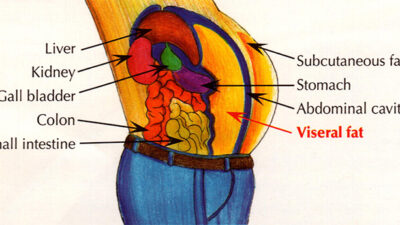 VisceralFat small 1 1