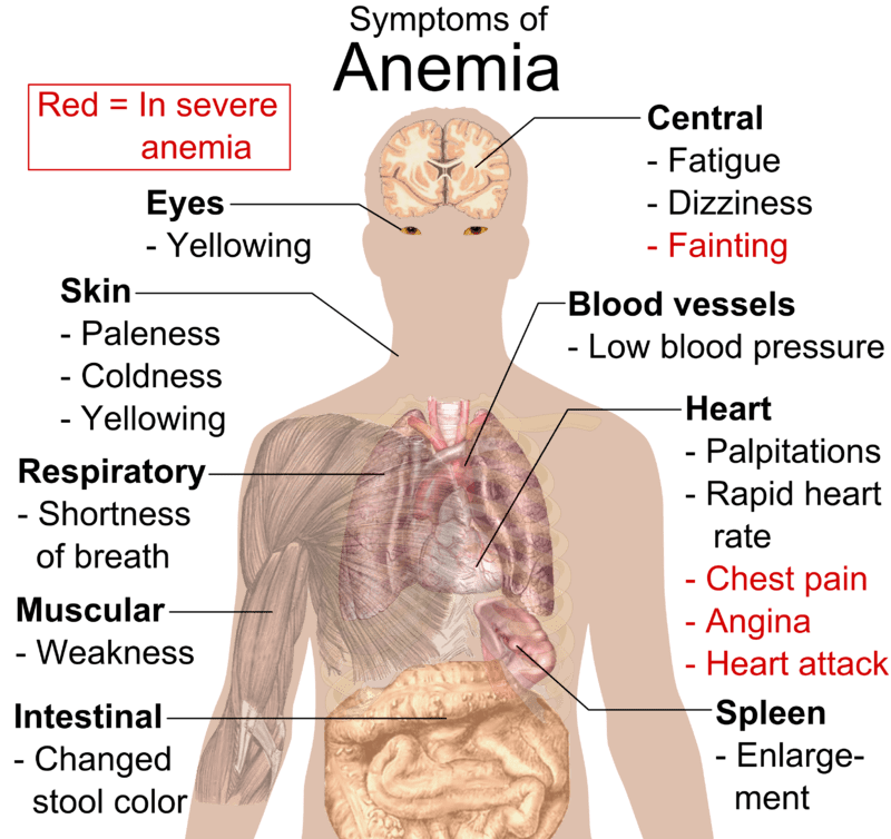 800px Symptoms of anemia 1 1